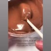 listing-video-1