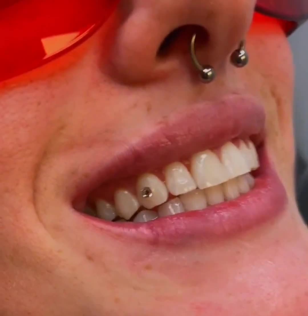 DIY Tooth Gem Kit: Clear Crystal Sparkle Applications (Up to 10) video poster