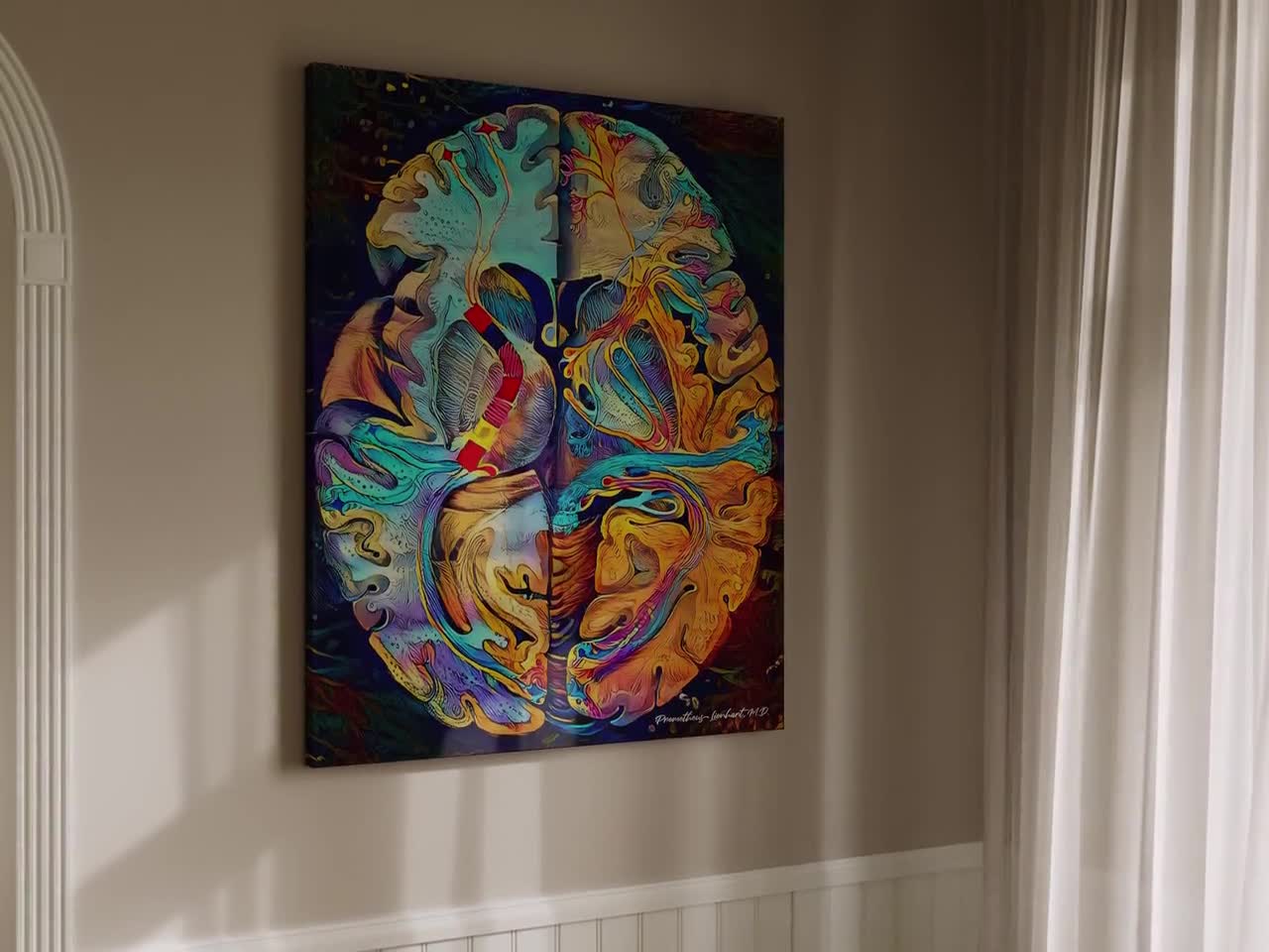 Brain Anatomy Art, Canvas or Acrylic, “alba Materia Cerebri