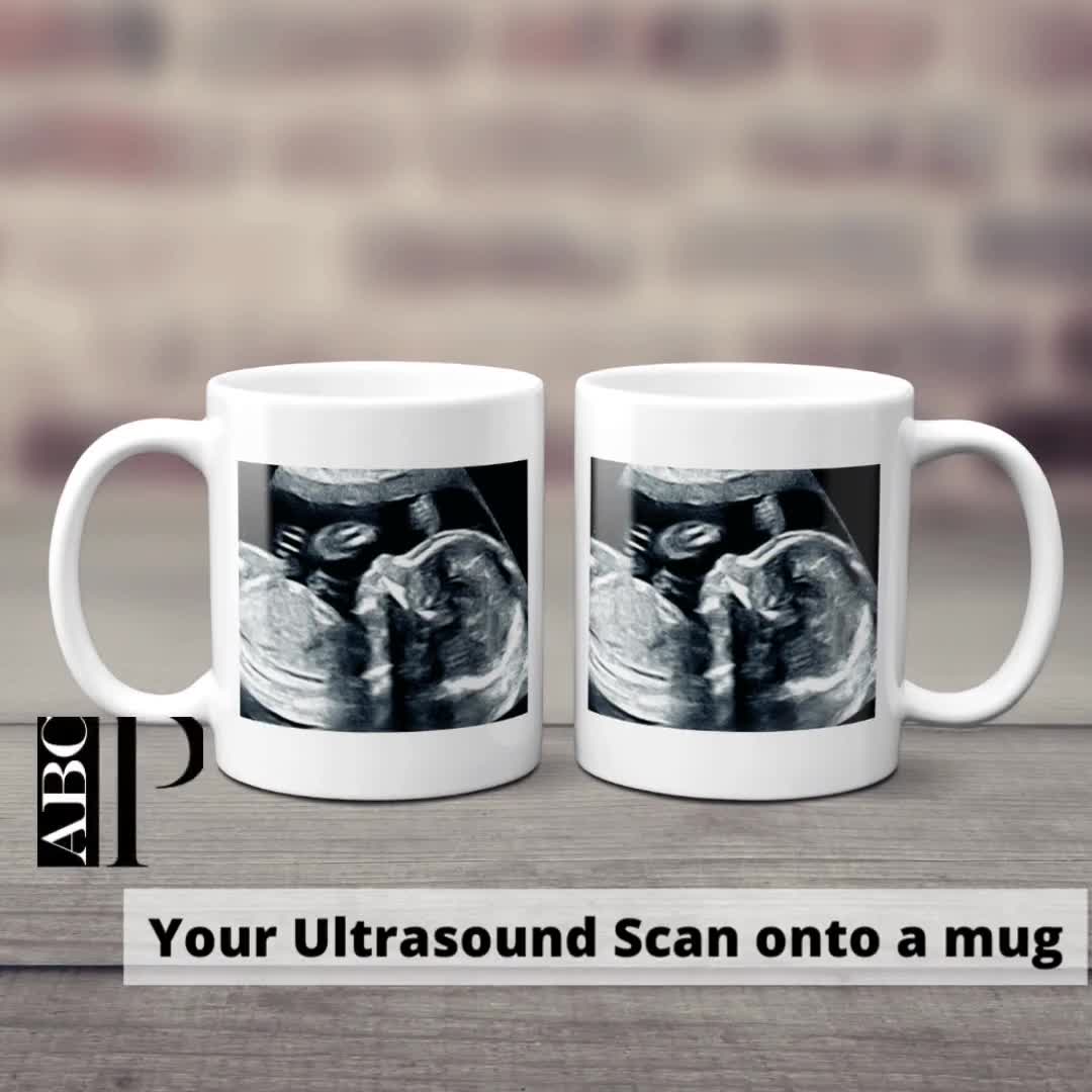 Large Slate authentic Ultrasound Keepsake