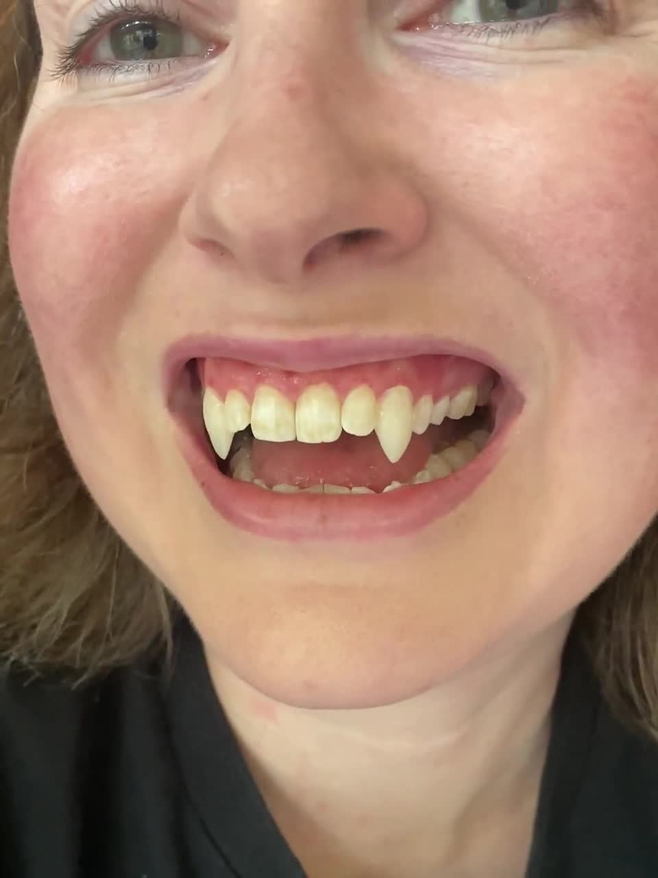 Custom Vampire Fangs - Etsy