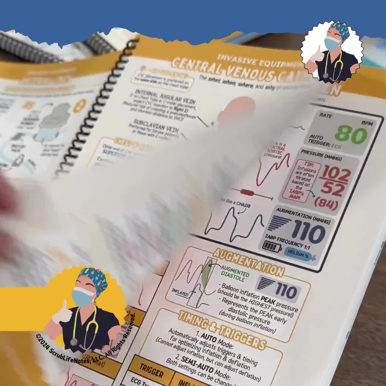 New to ICU® 2.0: A Visual Guide to Critical Care Nursing | 2nd Edition | Spiral Bound video poster