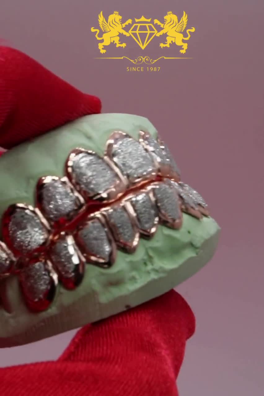 Custom Rose Gold Grillz: Diamond Dust Silver, 10K, 14K video poster