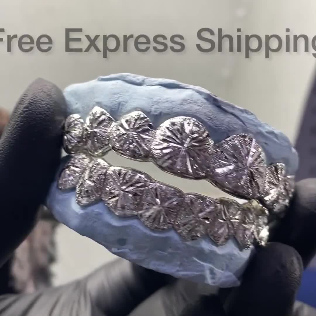 Custom Grillz, FREE Diamond Dust, 925 Silver Real 14K Gold , FREE Mold  Kits, Fast Process, FREE 2 Day Shipping by Grillz Jewelry 